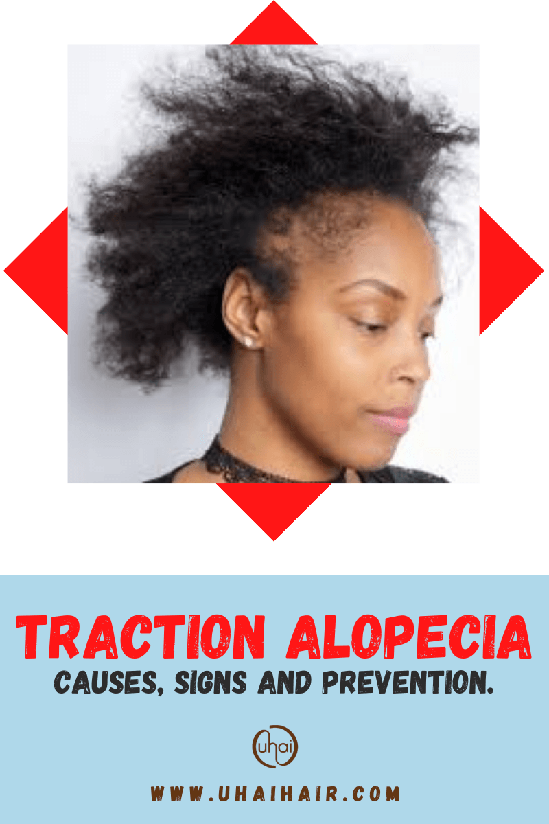 Understanding Traction Alopecia